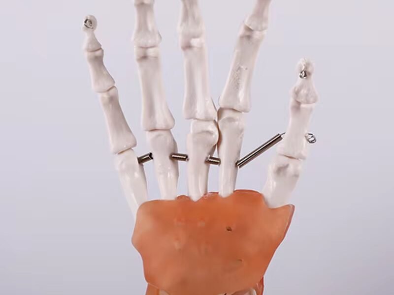 mano ligamento, para enseñanza, j3c119114