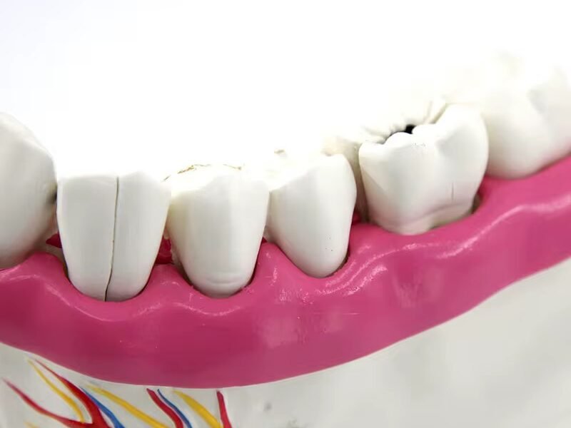 maxilar inferior, modelo 7022