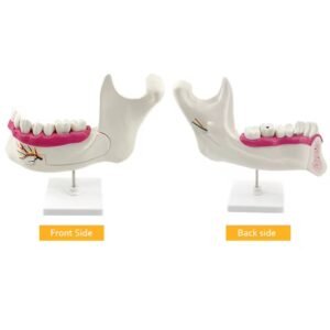 maxilar inferior, modelo 7022