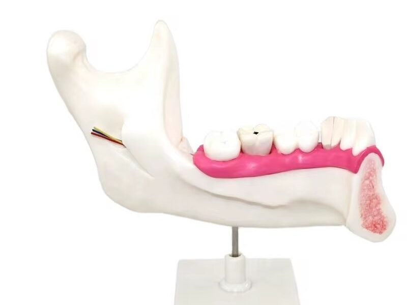 maxilar inferior, modelo 7022